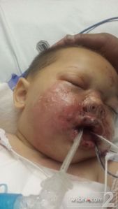 Baby hit by flashbang grenade, no charges to involved officers